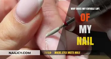 Why Cuticles Lift: Causes and Solutions for Healthy Nails