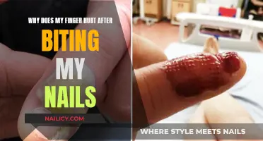 Biting Nails: Finger Pain and Its Causes