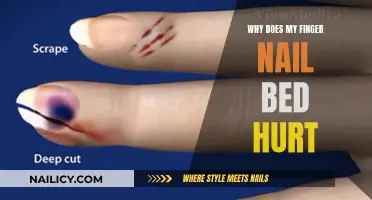 What Your Fingernail Pain Could Be Telling You