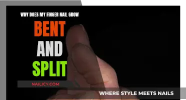 Bent and Split: Understanding Abnormal Nail Growth