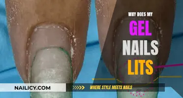 Gel Nails: Why They Lift and How to Prevent It