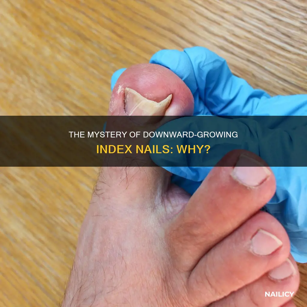 why does my index nail grow downwards