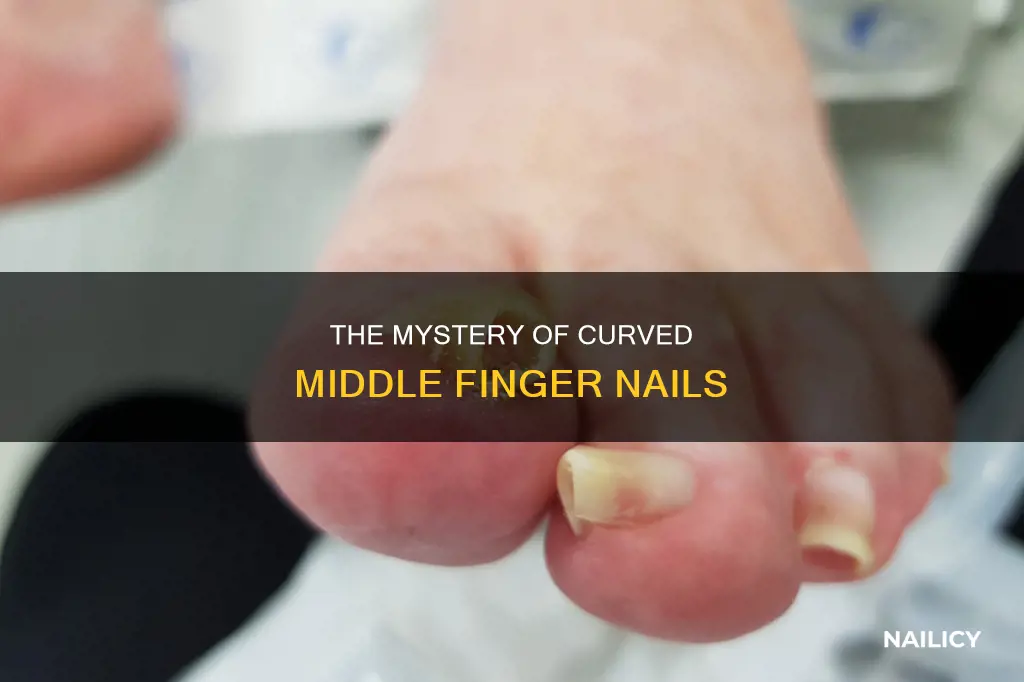 why does my middle finger nail curved