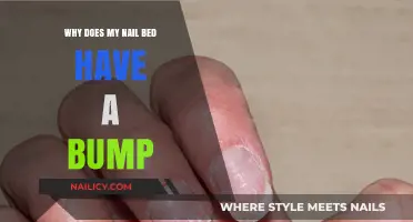 Bumpy Nail Beds: Causes, Concerns, and When to Seek Help