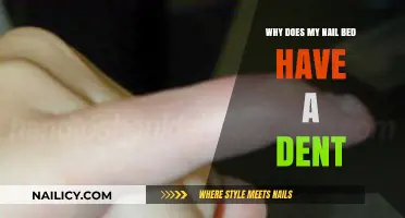 Why Do Nail Beds Develop Dents? Causes and Concerns Explained