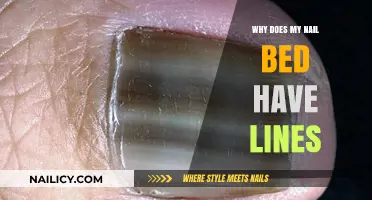 Why Do My Nail Beds Have Lines? Causes and Concerns Explained