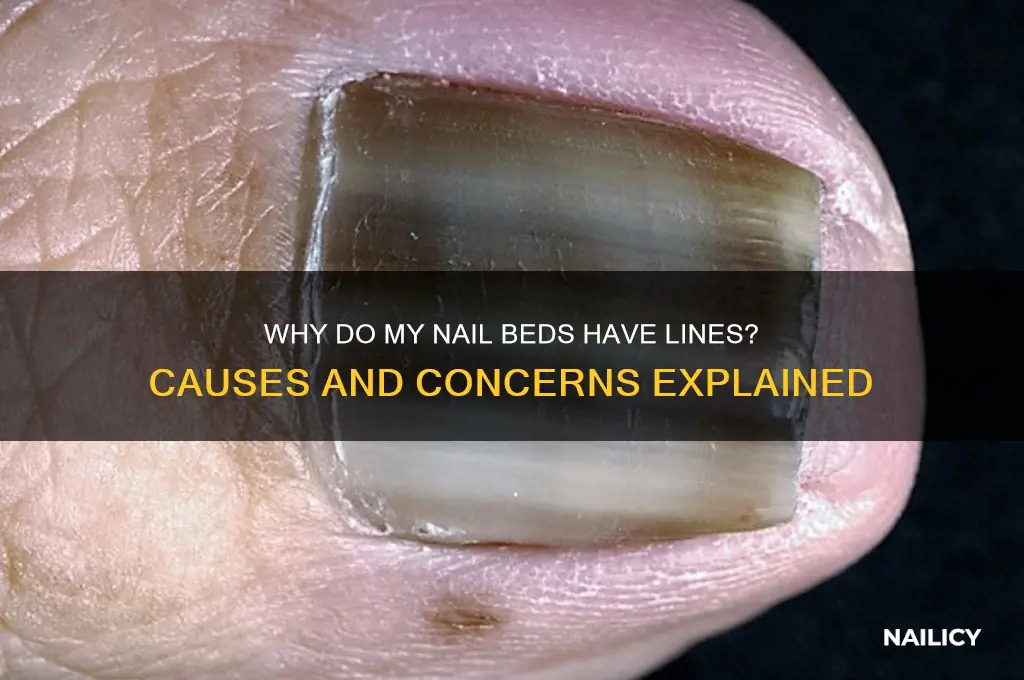 why does my nail bed have lines