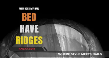 Why Do My Nail Beds Have Ridges? Causes and Solutions
