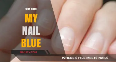 Why Are My Nails Blue? Causes, Concerns, and Solutions Explained