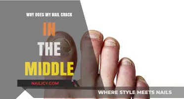 Why Do Nails Crack in the Middle? Causes and Solutions