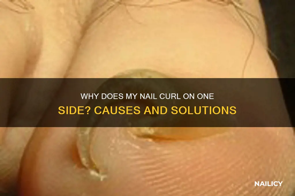 why does my nail curl on one side