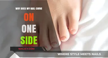 Curved Nail on One Side: Causes and Solutions Explained