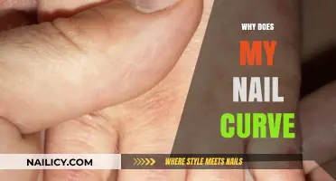 Why Do My Nails Curve? Understanding Nail Shape and Health