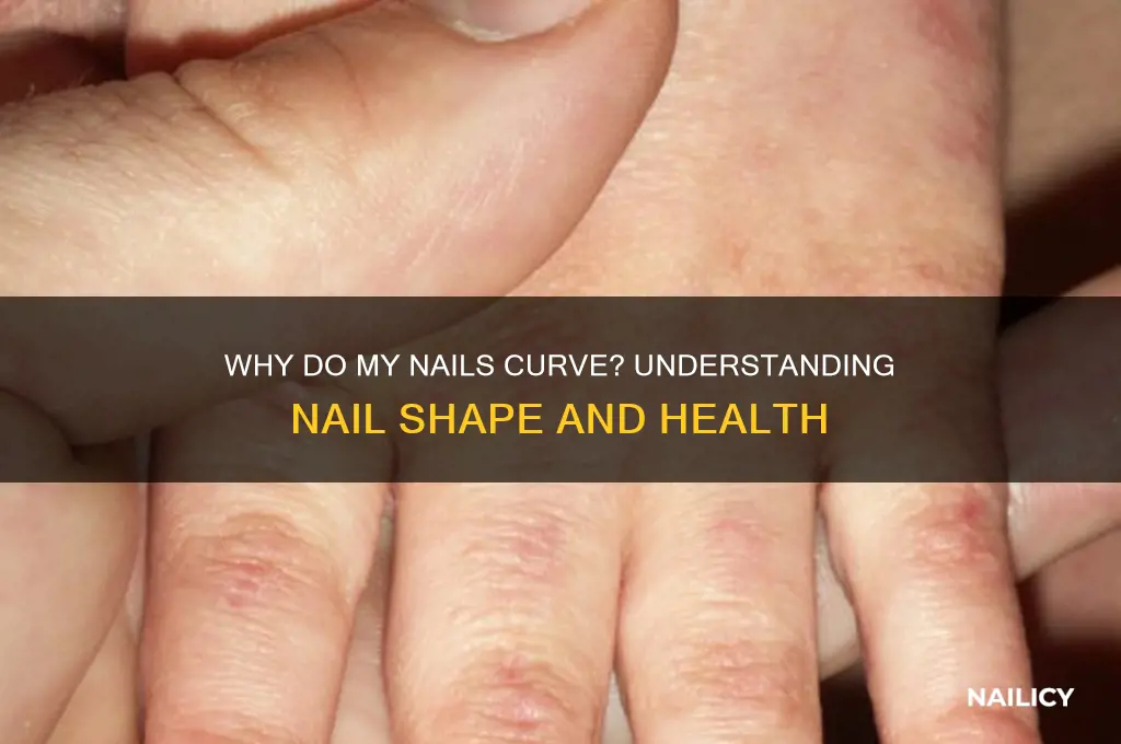 why does my nail curve
