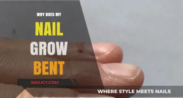 Nail Growth: Bent Nails and Their Causes