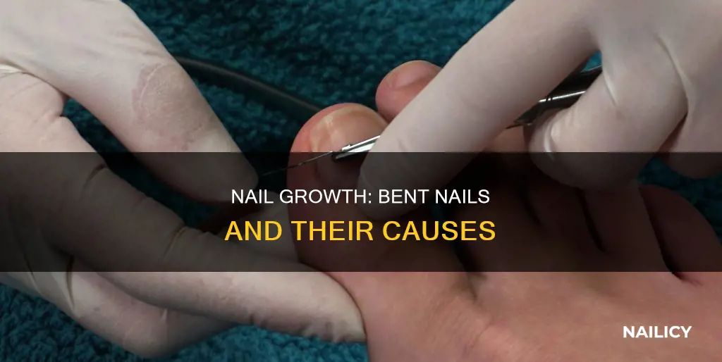 why does my nail grow bent