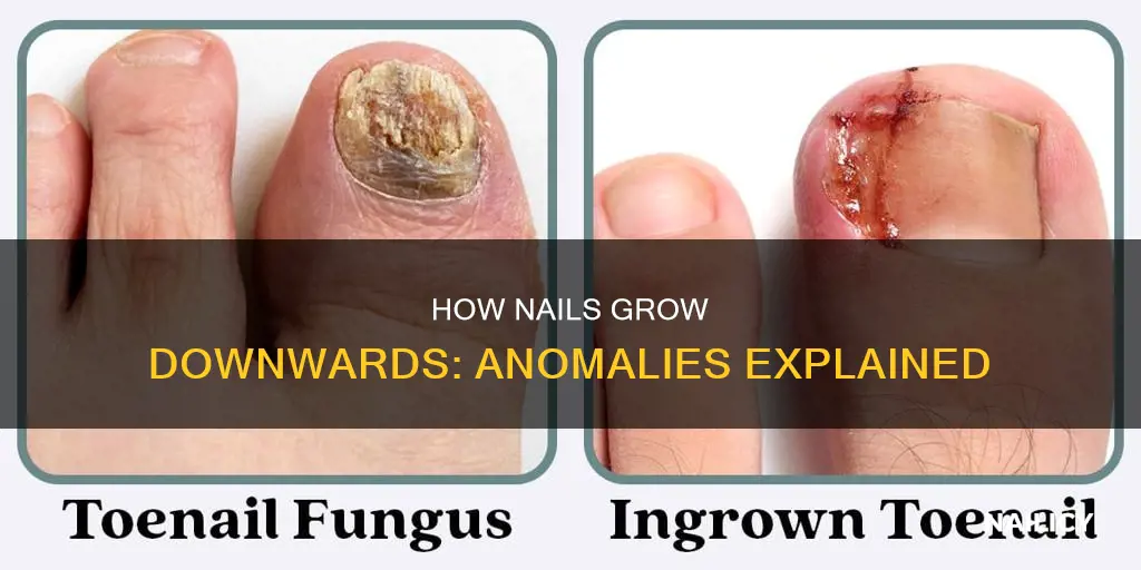 why does my nail grow downwards