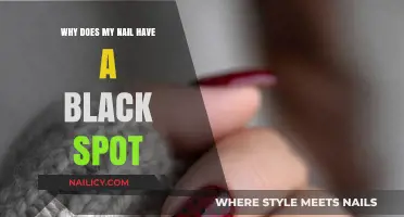 Black Spot on Nail: Causes, Concerns, and When to Seek Help