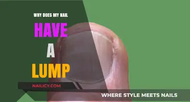 Why Does My Nail Have a Lump? Causes and Solutions Explained