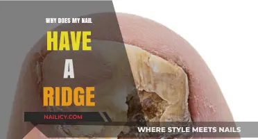 Understanding Nail Ridges: Causes, Concerns, and When to Seek Help