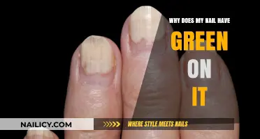 Green Nails: Causes, Concerns, and How to Treat Discoloration
