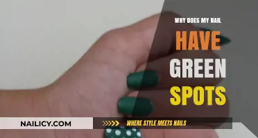 Green Spots on Nails: Causes, Concerns, and Treatment Options Explained