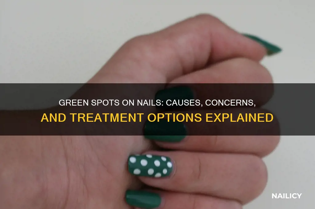 why does my nail have green spots