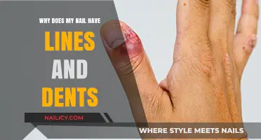 Understanding Nail Lines and Dents: Causes and Solutions Explained