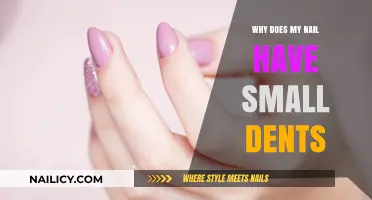 Small Dents on Nails: Causes, Concerns, and Solutions Explained