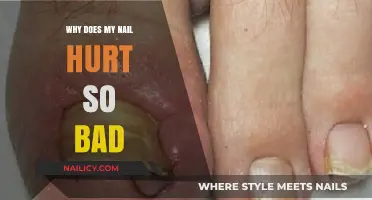 Why Does My Nail Hurt So Bad? Causes and Remedies Explained