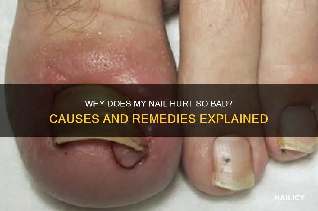 why does my nail hurt so bad