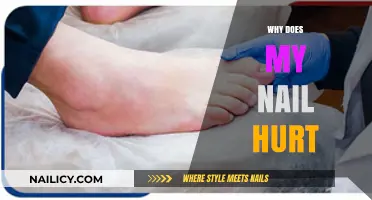 Why Does My Nail Hurt? Common Causes and Quick Relief Tips