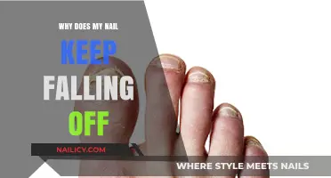 Why Do My Nails Keep Falling Off? Causes and Solutions