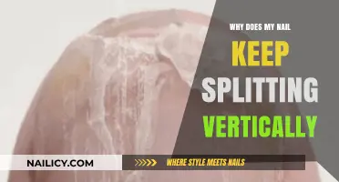 Why Do My Nails Split Vertically? Causes and Solutions