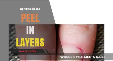 Why Do My Nails Peel in Layers? Causes and Solutions