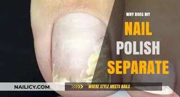 Why Does My Nail Polish Separate? Causes and Solutions Explained