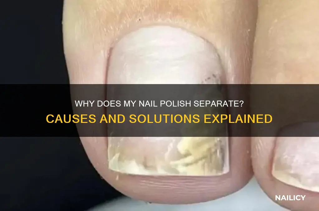 why does my nail polish separate