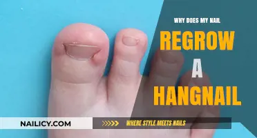 Why Hangnails Keep Coming Back: Understanding Nail Regrowth and Prevention