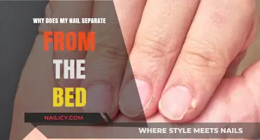 Why Does My Nail Separate from the Bed? Causes and Solutions