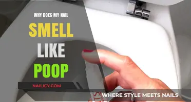 Why Do My Nails Smell Like Poop? Causes and Solutions
