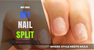Why Does My Nail Split? Causes, Prevention, and Effective Solutions