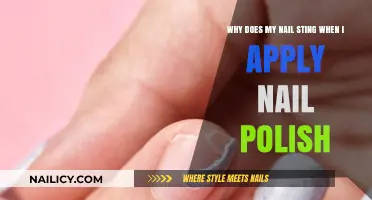 Why Does My Nail Sting When I Apply Nail Polish?