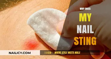 Why Does My Nail Sting? Causes, Remedies, and Prevention Tips