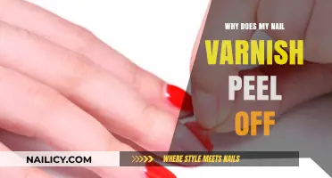 Why Does My Nail Varnish Peel Off? Common Causes and Fixes