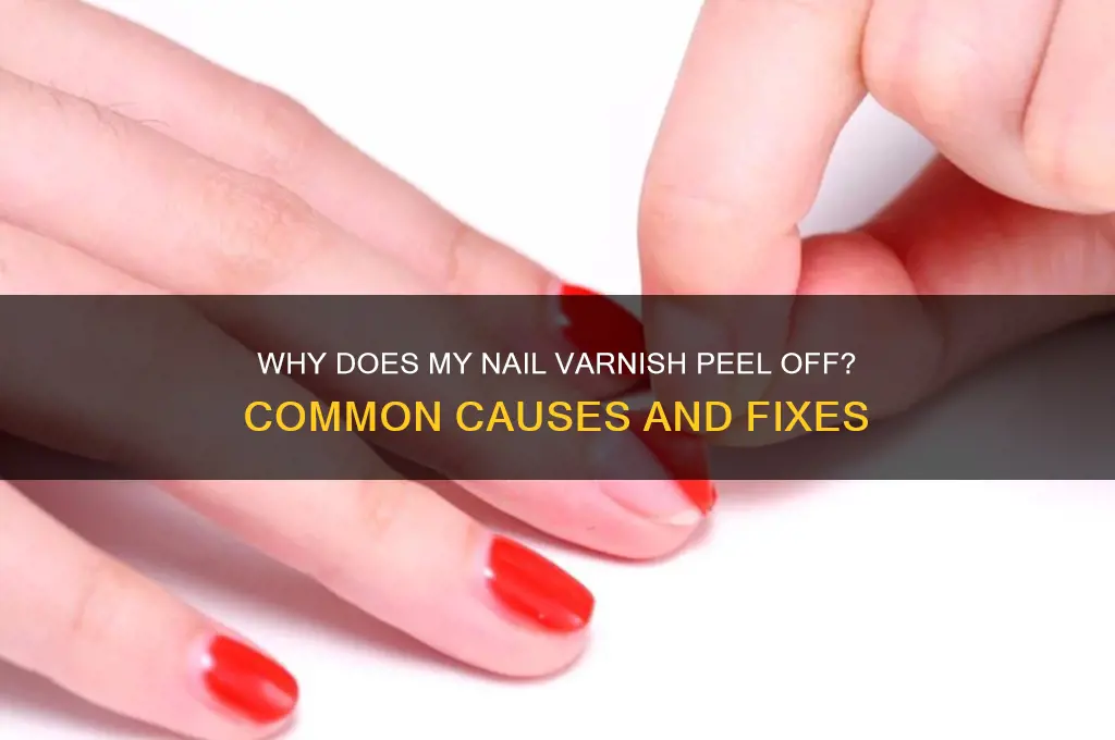 why does my nail varnish peel off