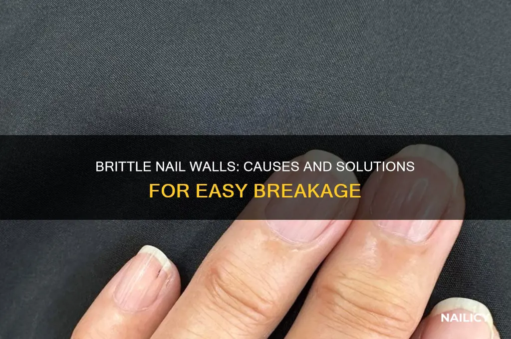 why does my nail wall break so easily