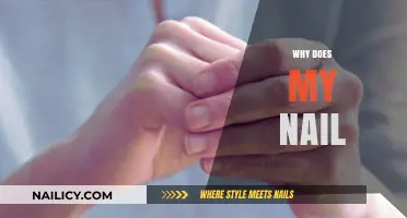 Why Does My Nail Hurt, Split, or Discolor? Common Causes Explained