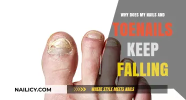 Why Do My Nails and Toenails Keep Falling Off?