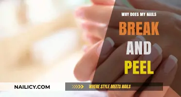 Why Do My Nails Break and Peel? Causes and Solutions