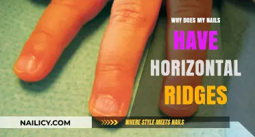 Horizontal Nail Ridges: Causes, Concerns, and Effective Solutions Explained